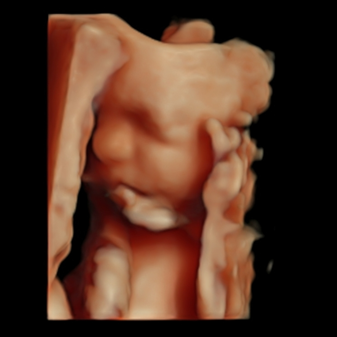 Photo shared by Evelyn for their Babylist baby registry.