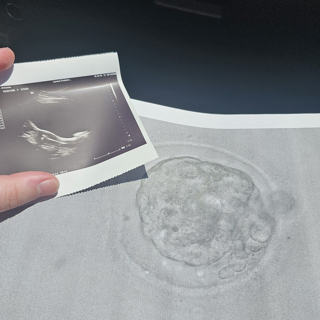 Photo shared by Madison for their Babylist baby registry.