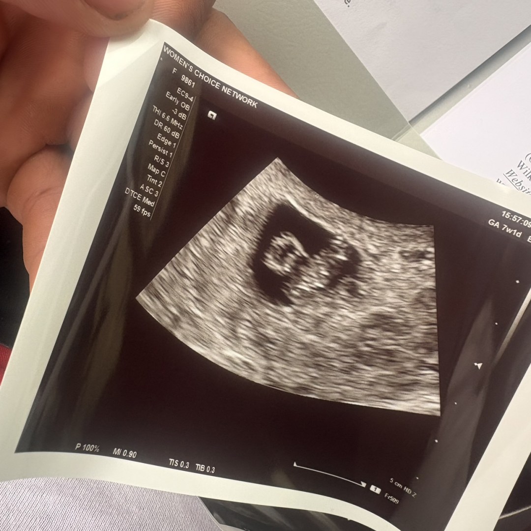 Photo shared by Cameron for their Babylist baby registry.