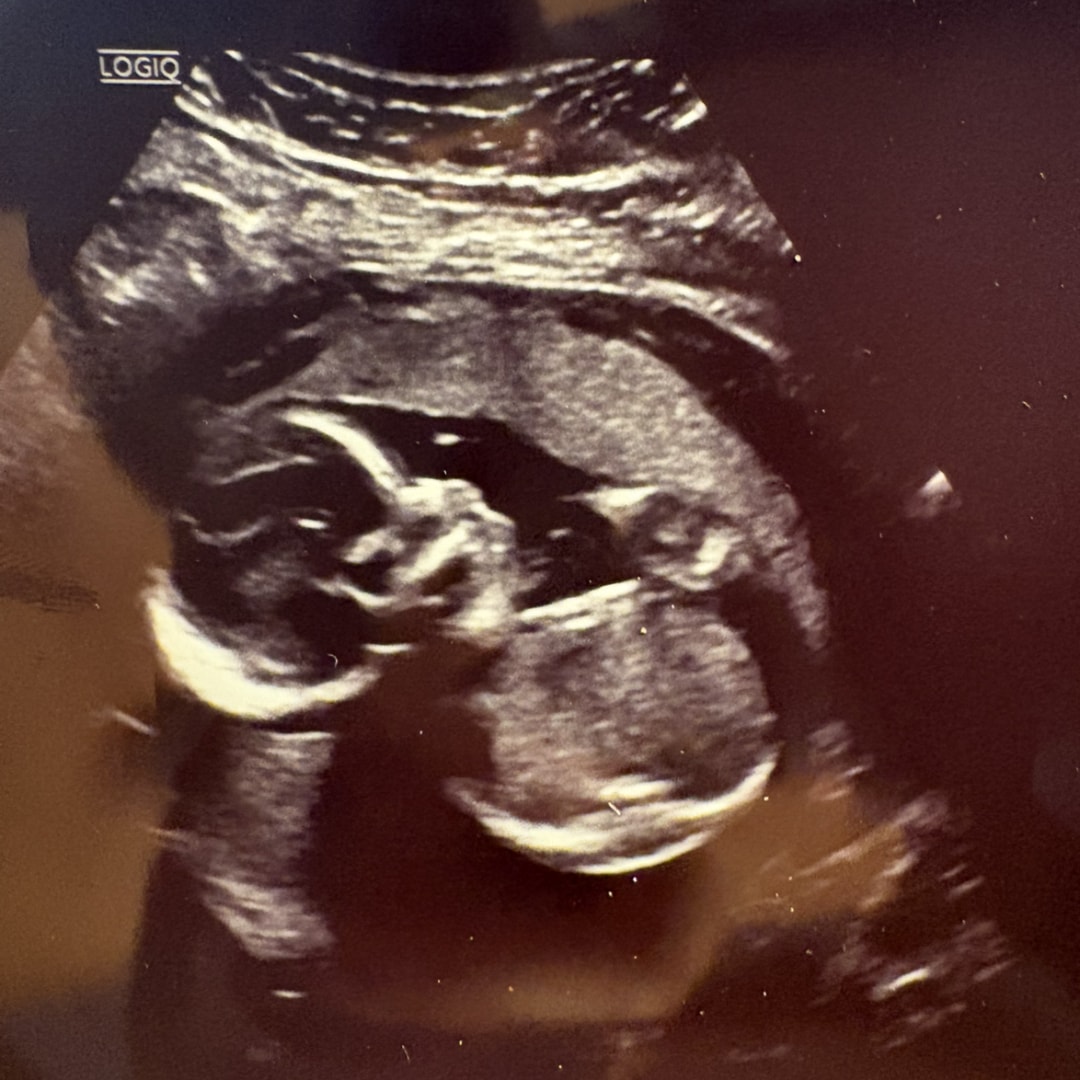 Photo shared by Haley for their Babylist baby registry.