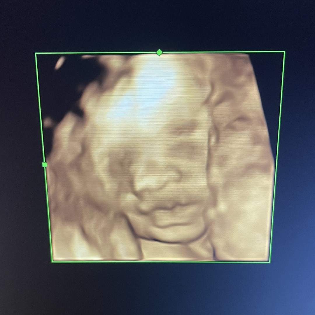 Photo shared by Mia for their Babylist baby registry.