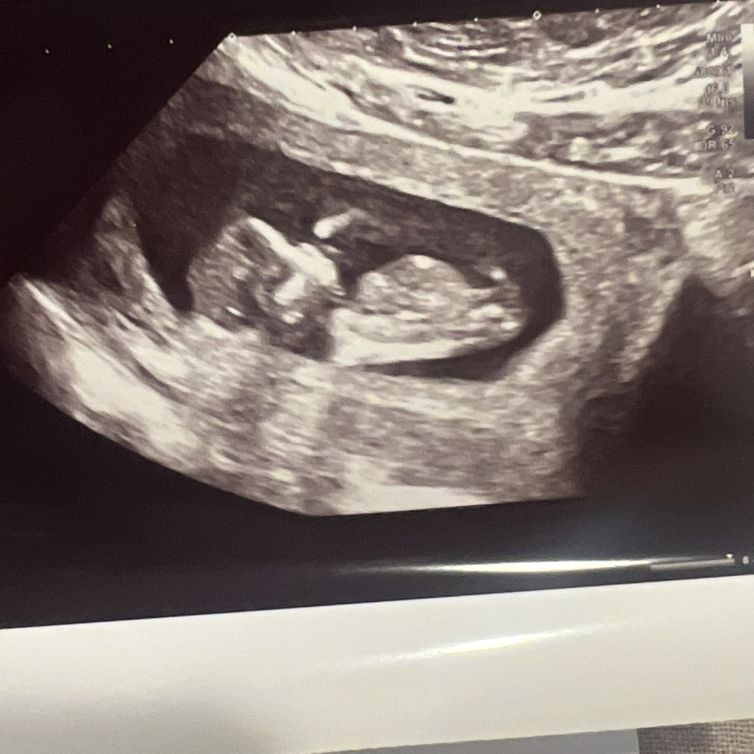 Photo shared by Cristina for their Babylist baby registry.