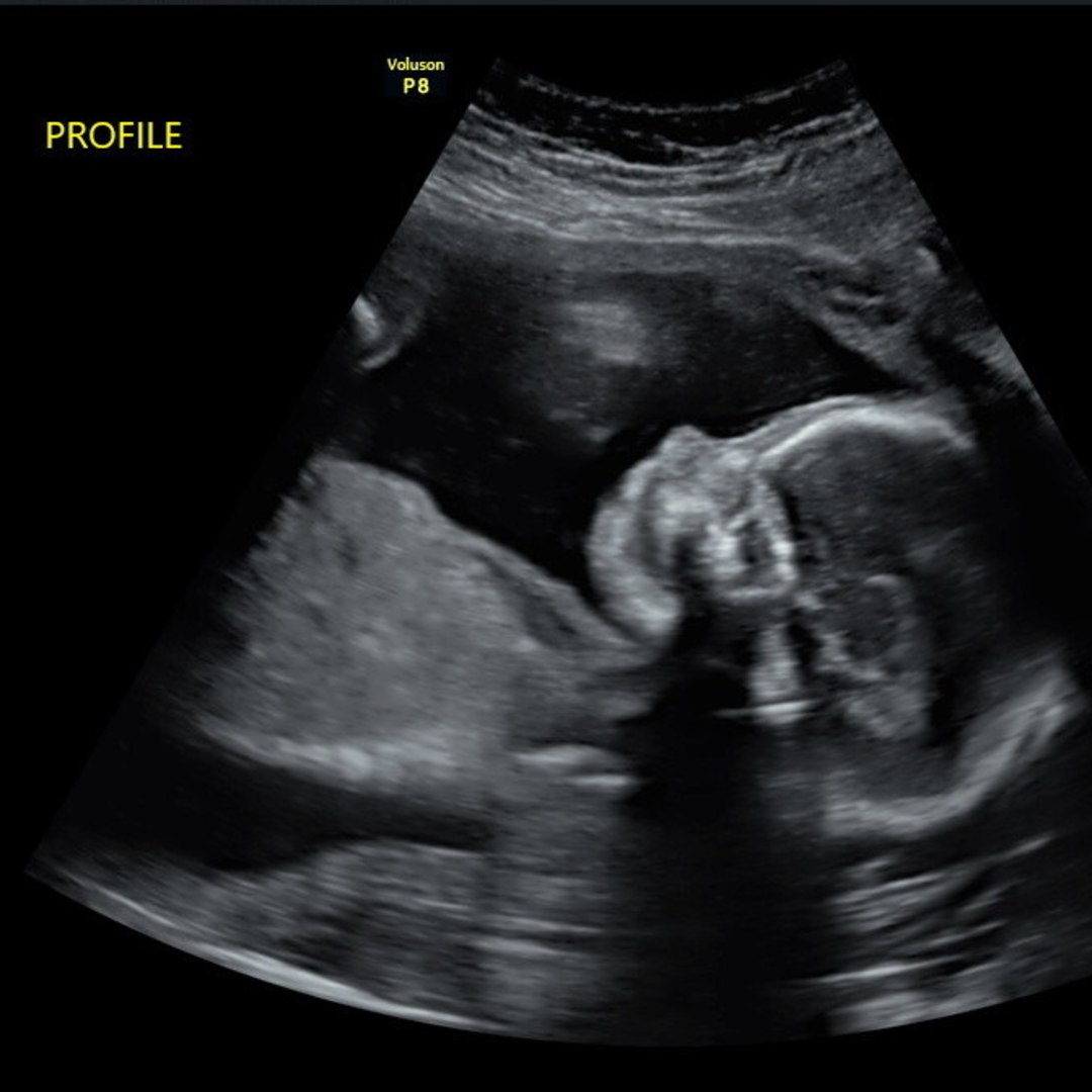 Photo shared by Abigail for their Babylist baby registry.
