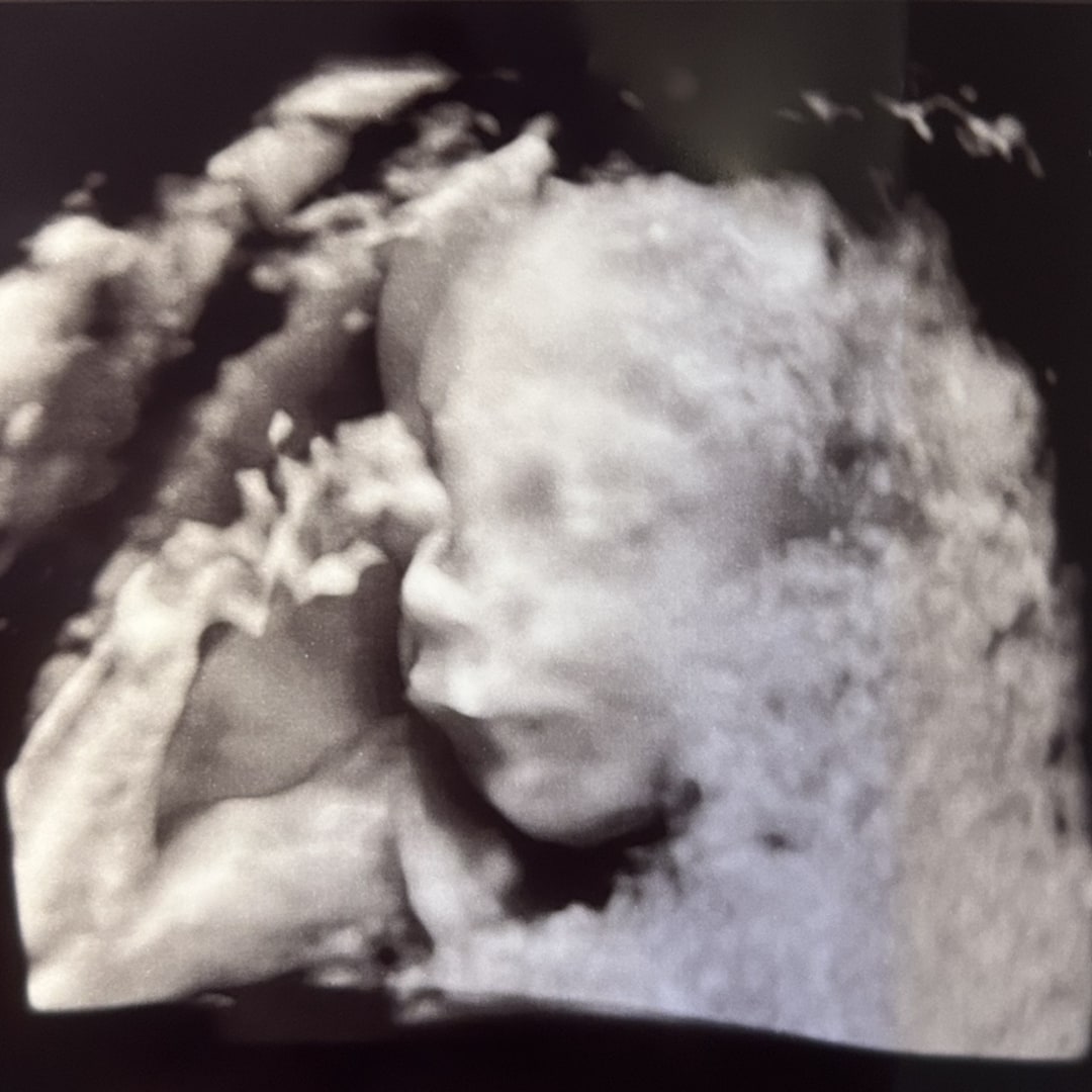 Photo shared by Claire for their Babylist baby registry.