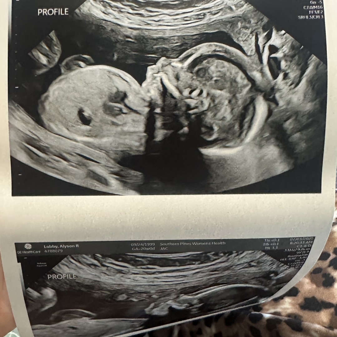 Photo shared by Alyson for their Babylist baby registry.