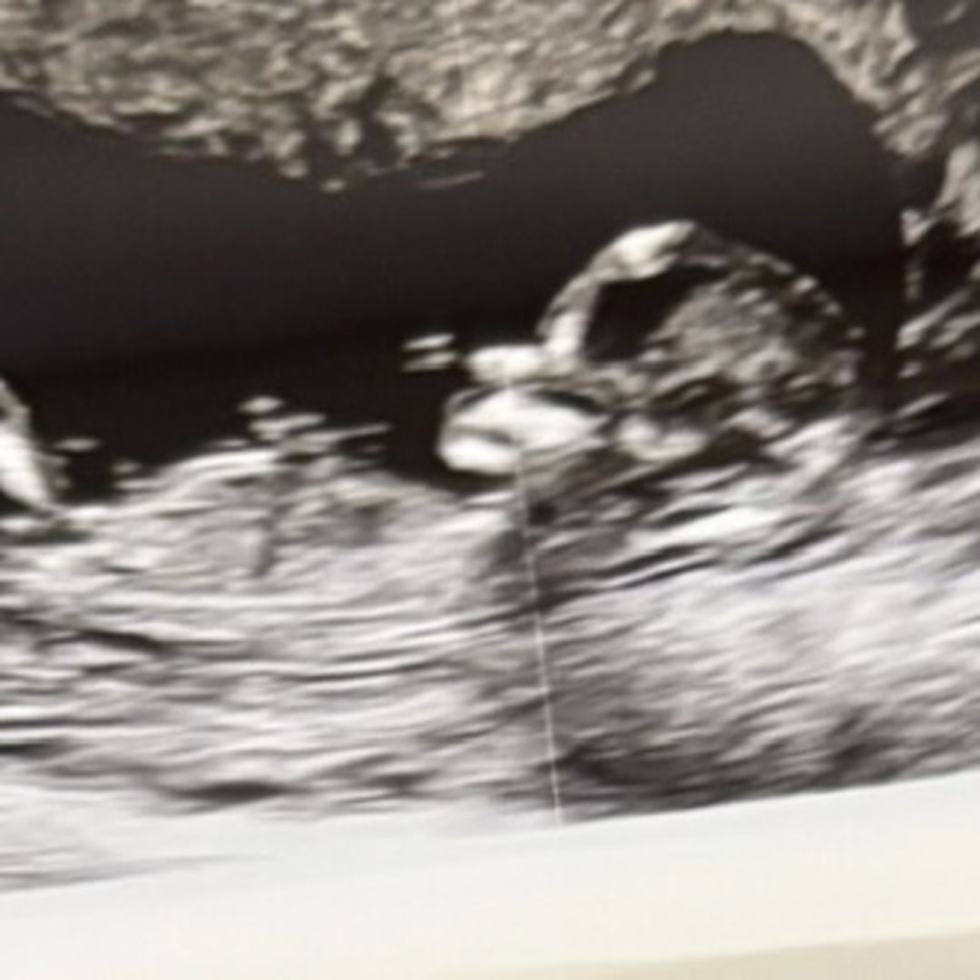 Photo shared by Alexandra for their Babylist baby registry.