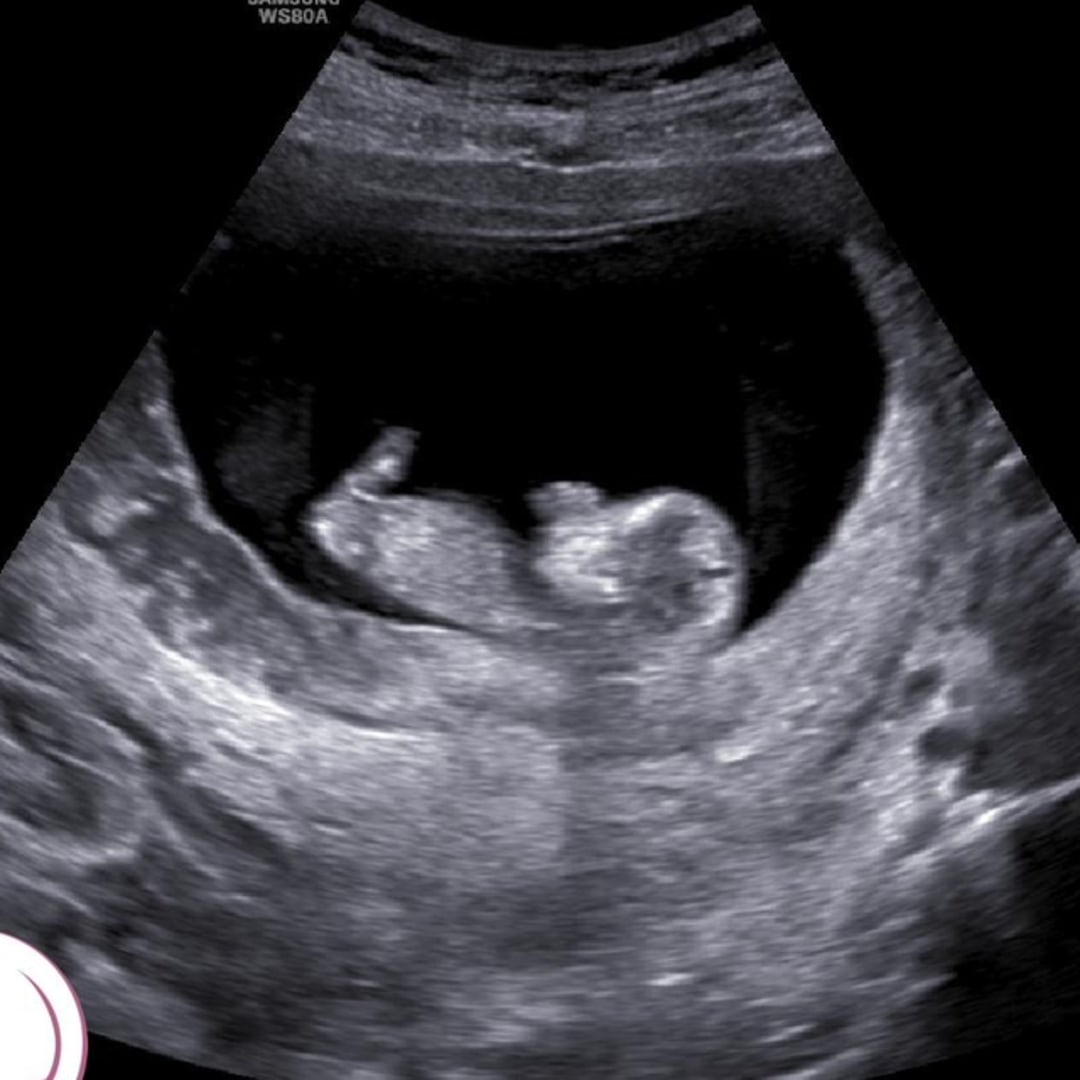 Photo shared by Chloe for their Babylist baby registry.