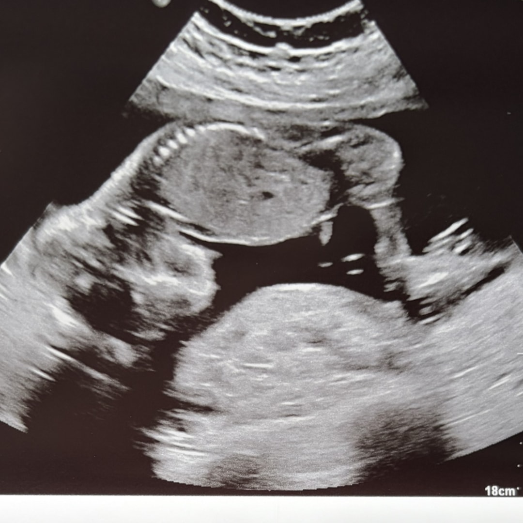 Photo shared by Bella for their Babylist baby registry.