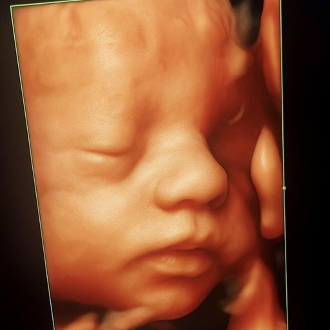 Photo shared by Kari for their Babylist baby registry.