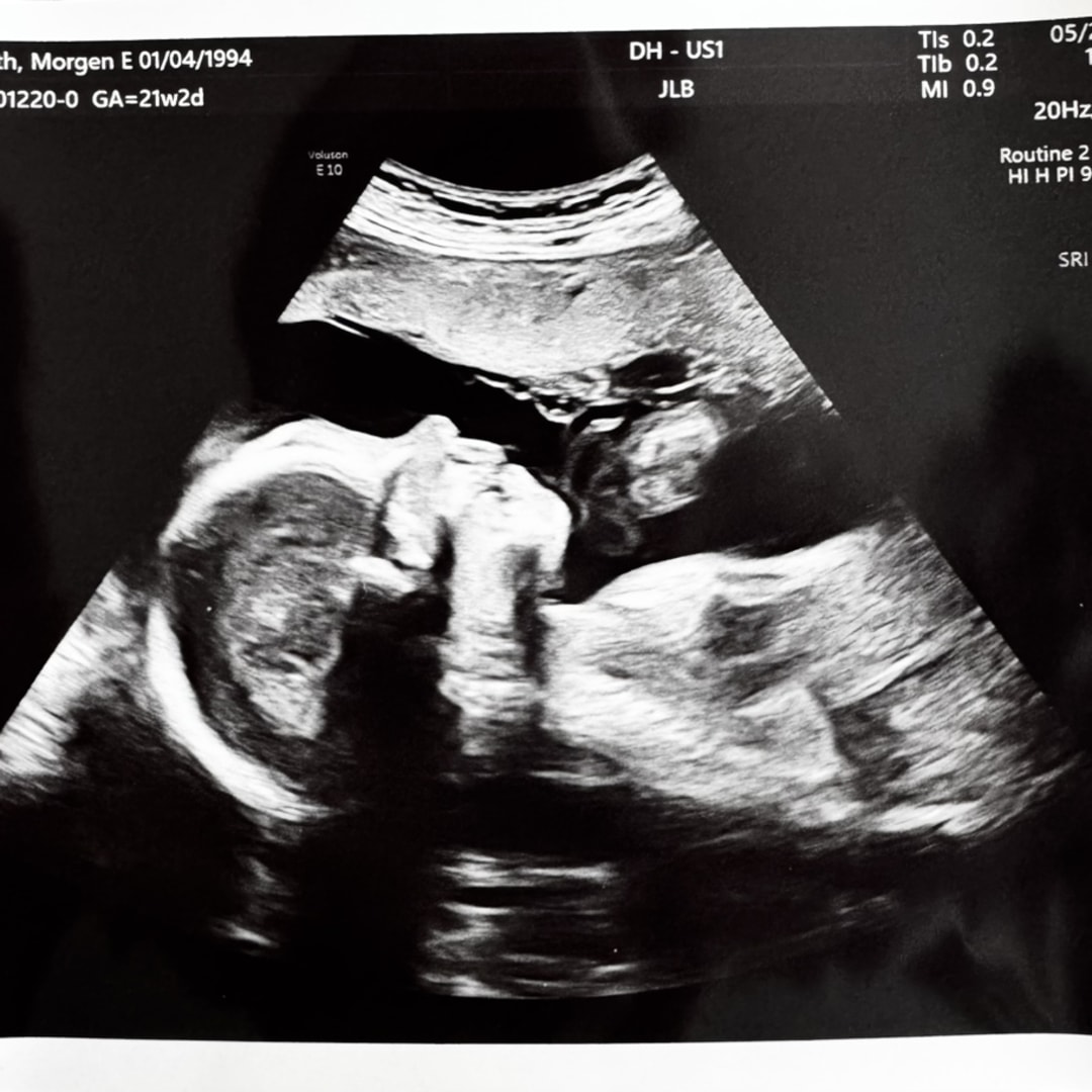 Photo shared by Morgen for their Babylist baby registry.