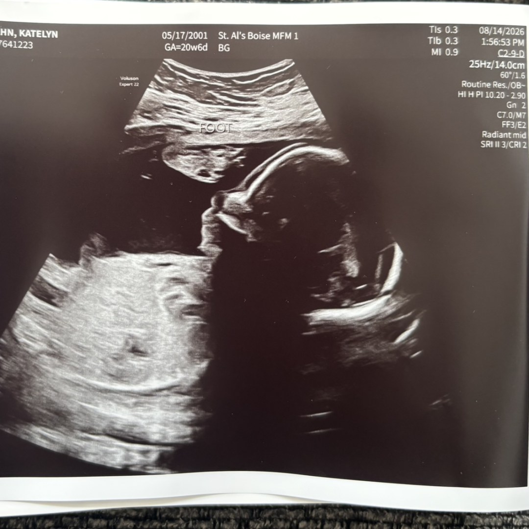 Photo shared by Katelyn for their Babylist baby registry.