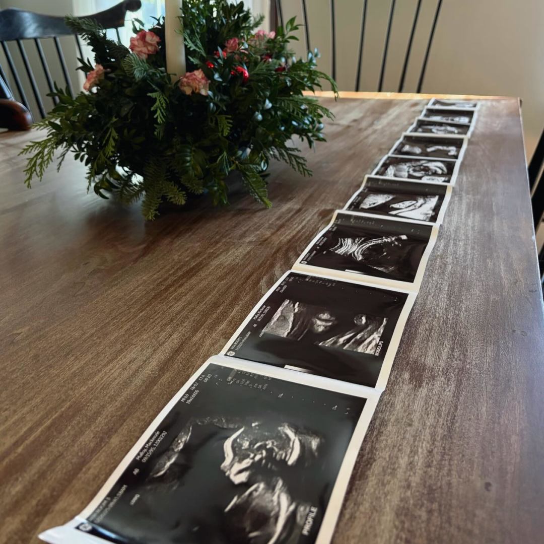 Photo shared by Mackenzie for their Babylist baby registry.