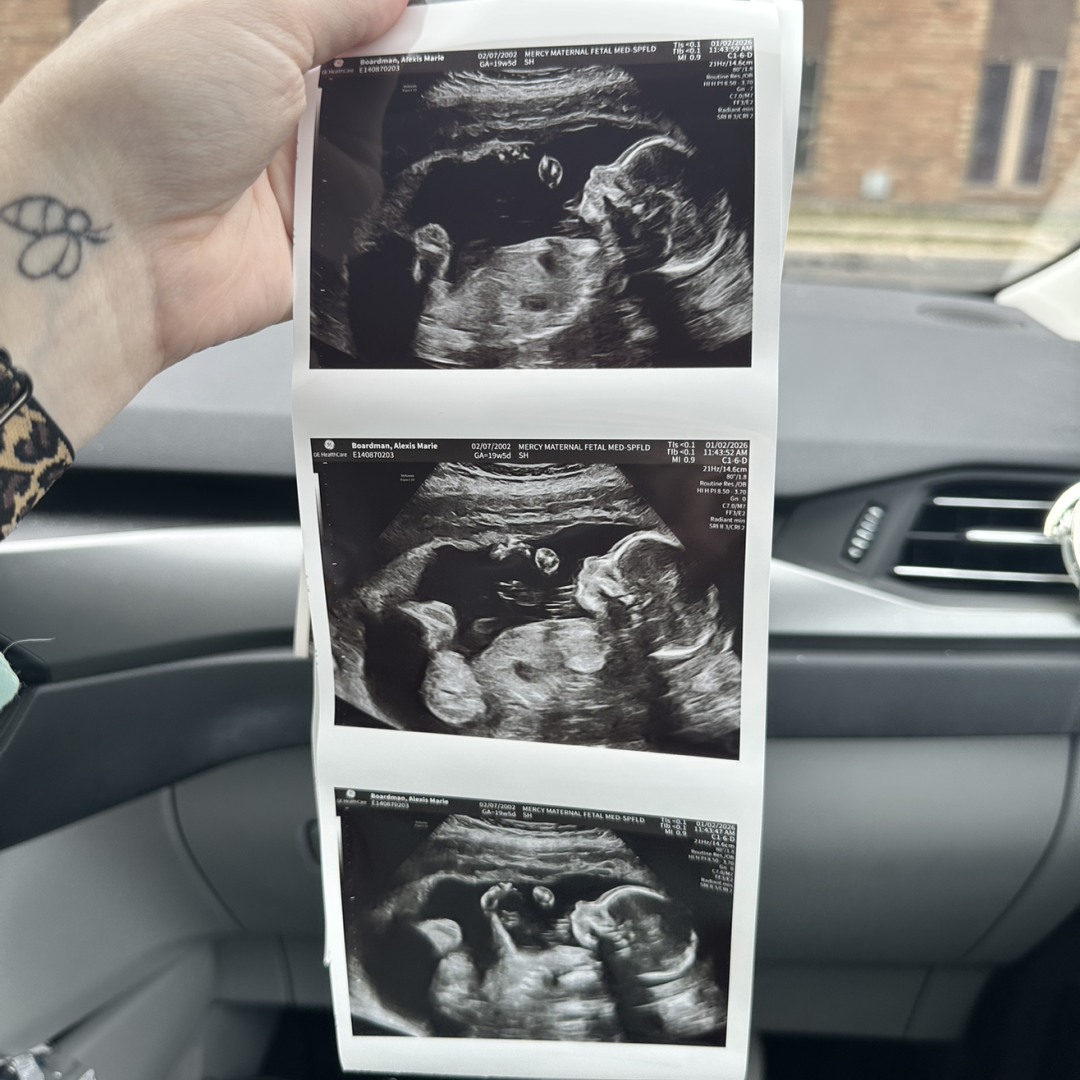 Photo shared by Lexi for their Babylist baby registry.