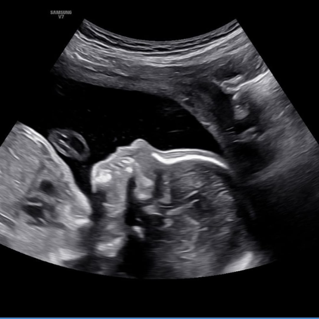 Photo shared by Cassie for their Babylist baby registry.