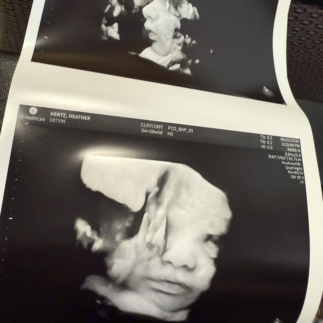 Photo shared by Heather for their Babylist baby registry.