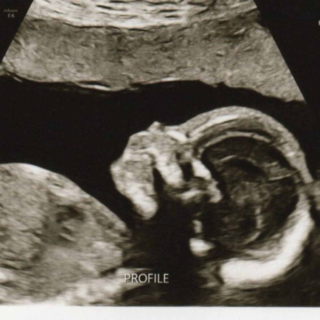 Photo shared by Lauren for their Babylist baby registry.