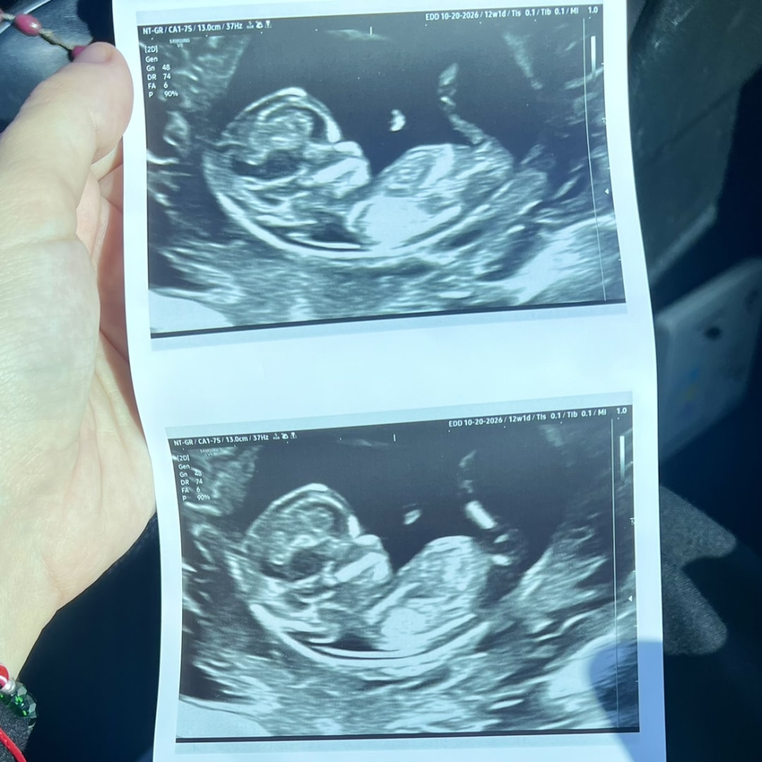 Photo shared by Karla for their Babylist baby registry.