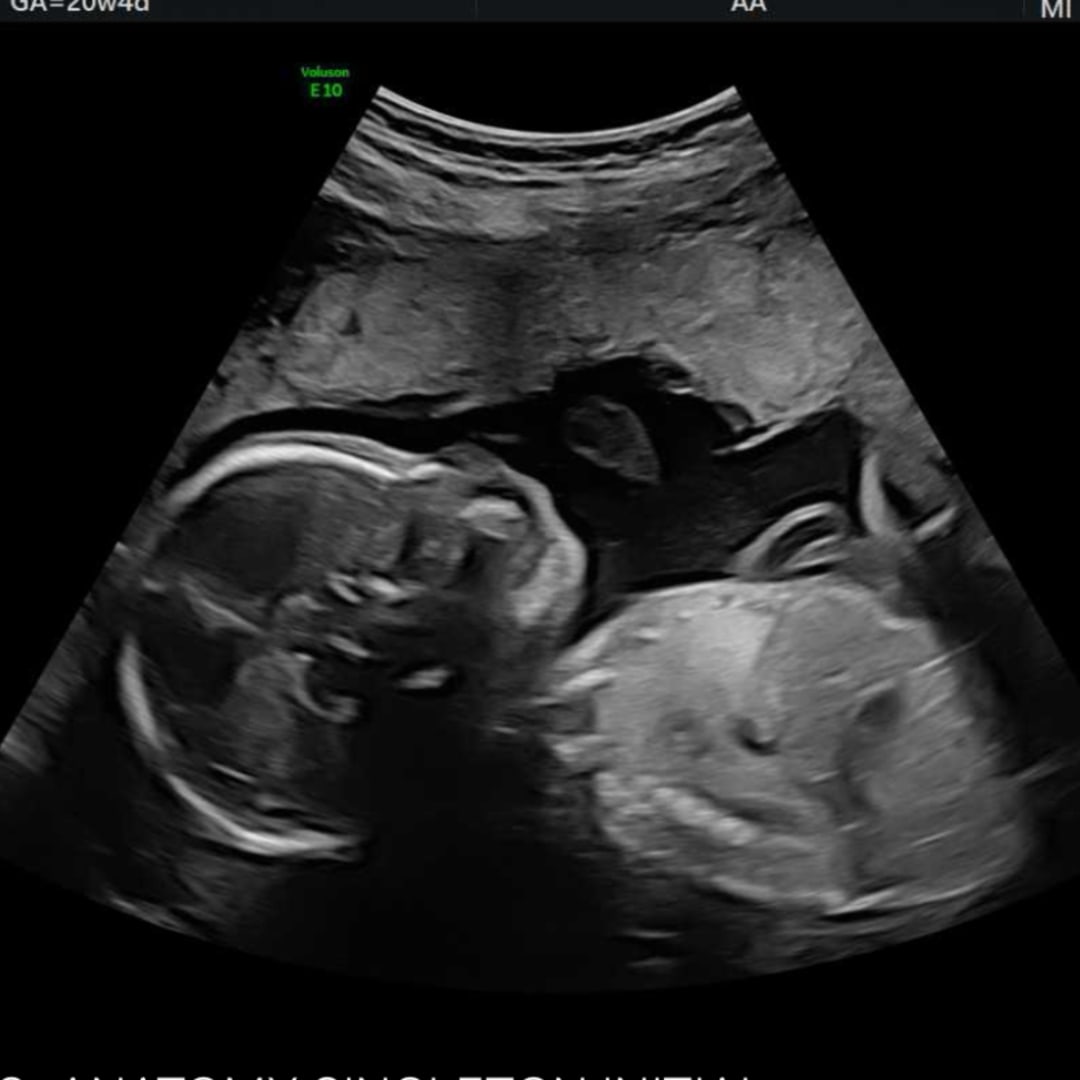 Photo shared by Jenna for their Babylist baby registry.