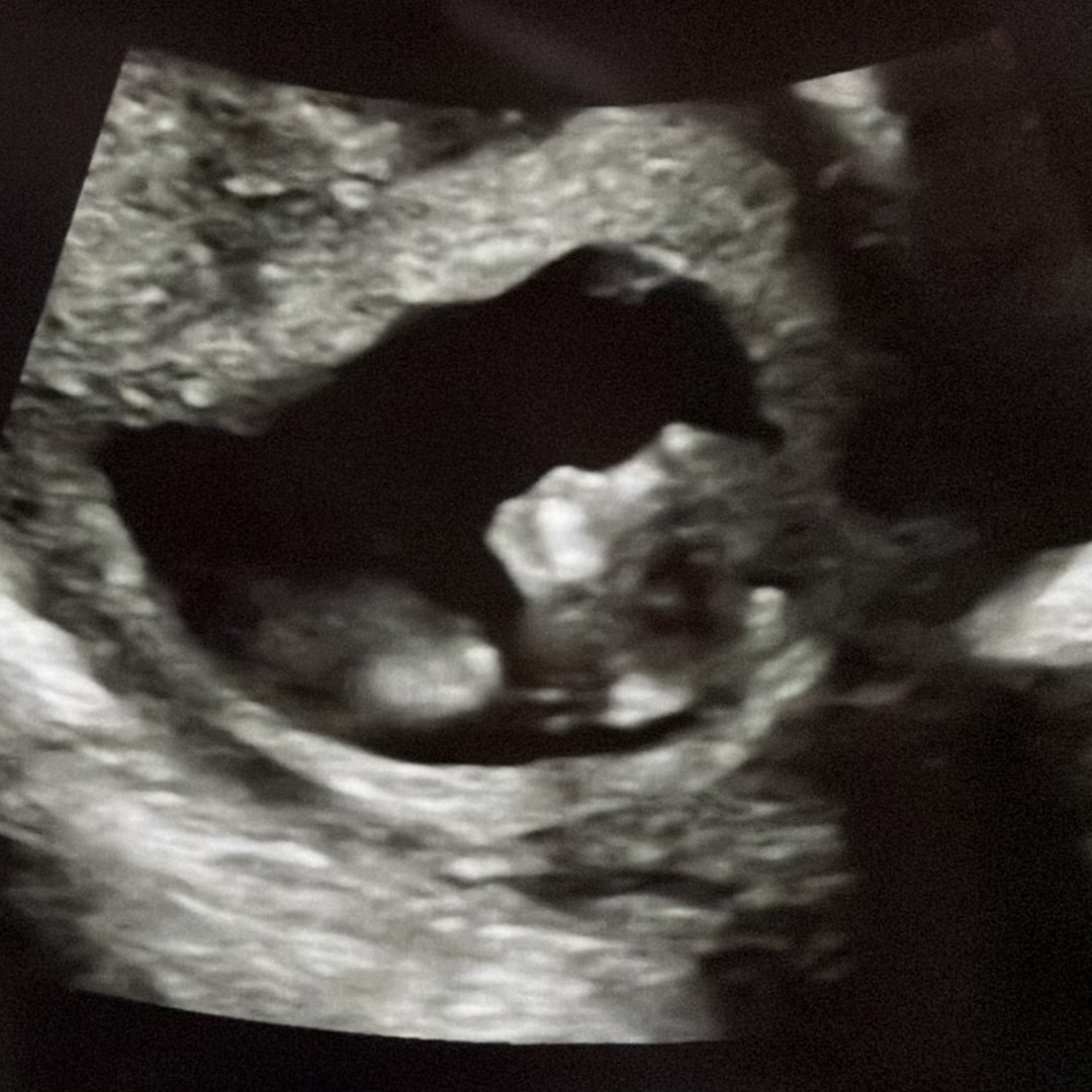 Photo shared by Andrea for their Babylist baby registry.