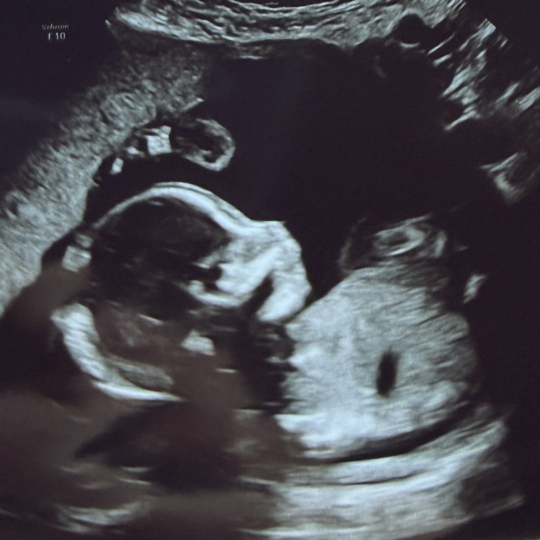 Photo shared by Denaya for their Babylist baby registry.