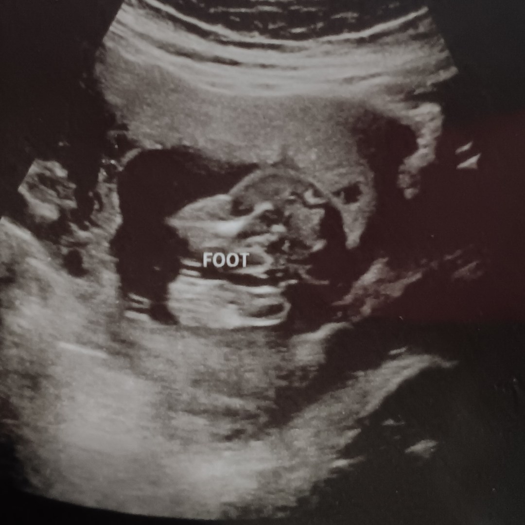 Photo shared by Kira for their Babylist baby registry.