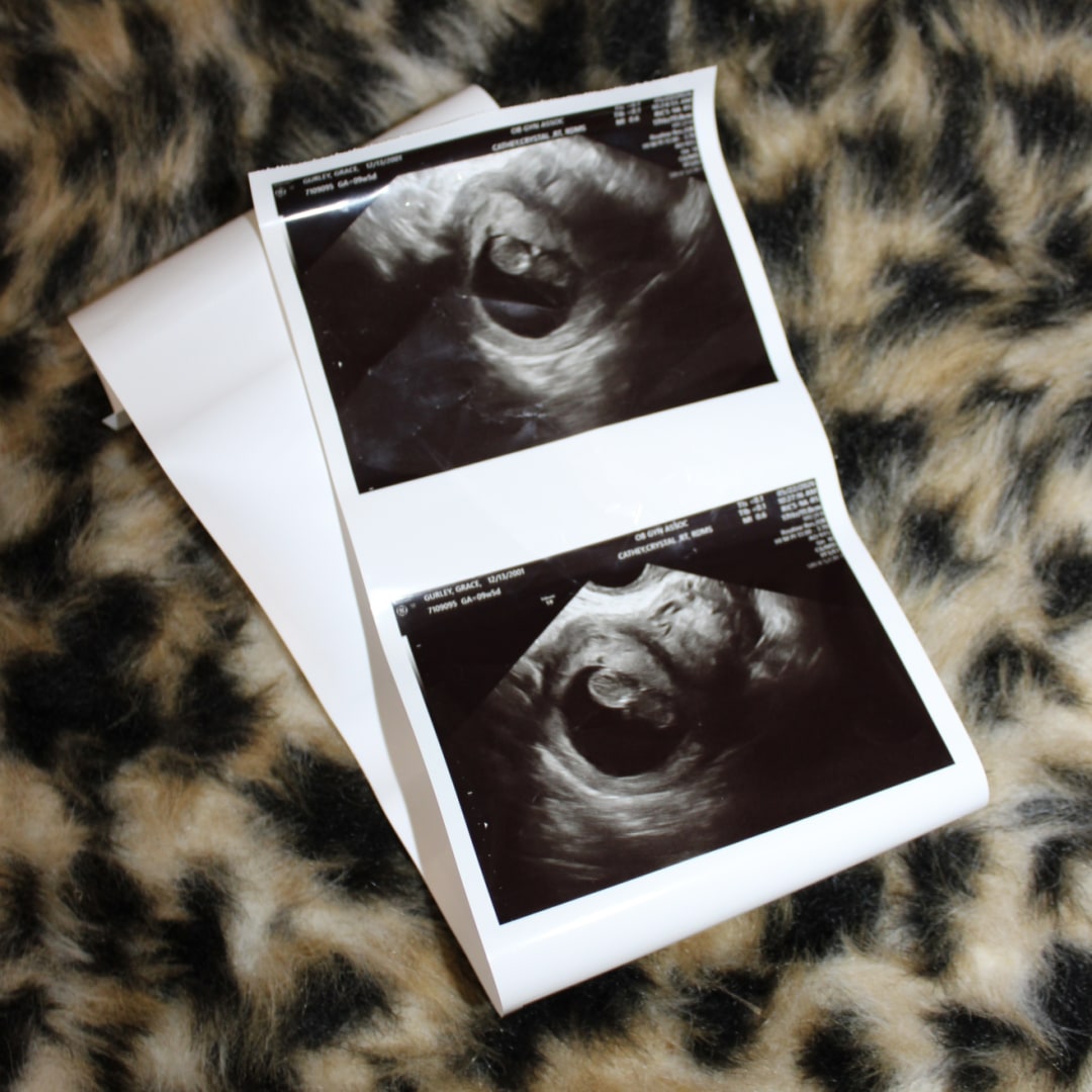 Photo shared by Grace for their Babylist baby registry.