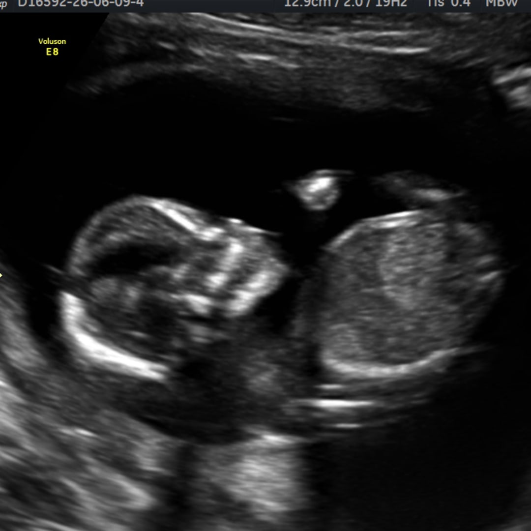 Photo shared by Anabel for their Babylist baby registry.