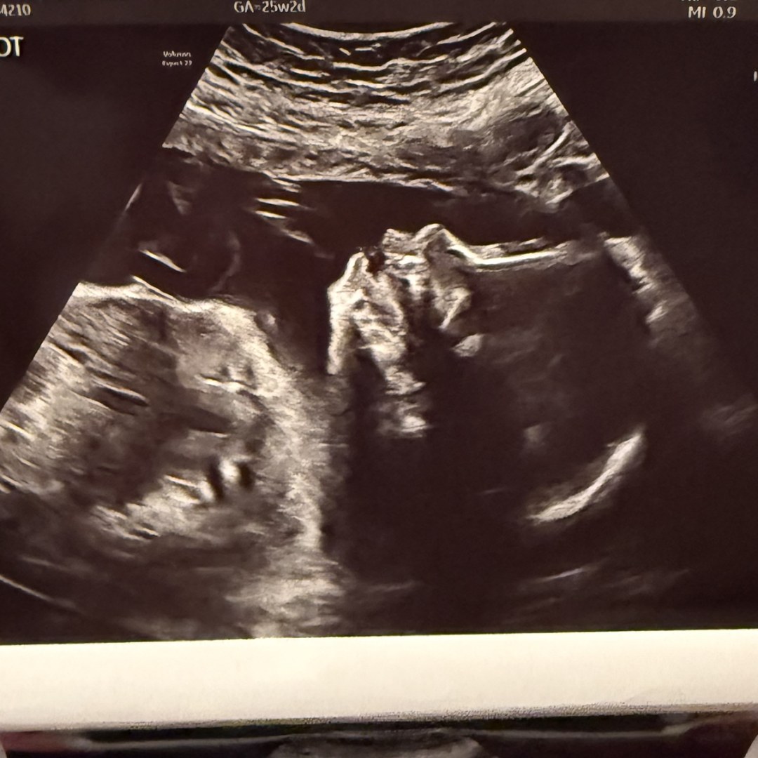 Photo shared by Hailey for their Babylist baby registry.