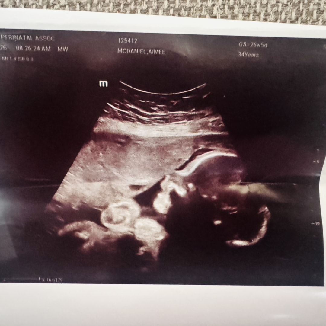 Photo shared by Aimee for their Babylist baby registry.
