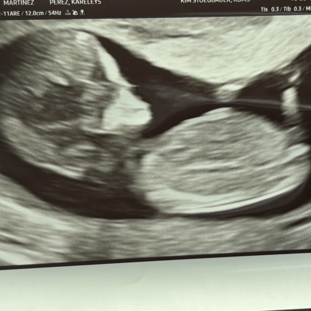 Photo shared by Karelys for their Babylist baby registry.