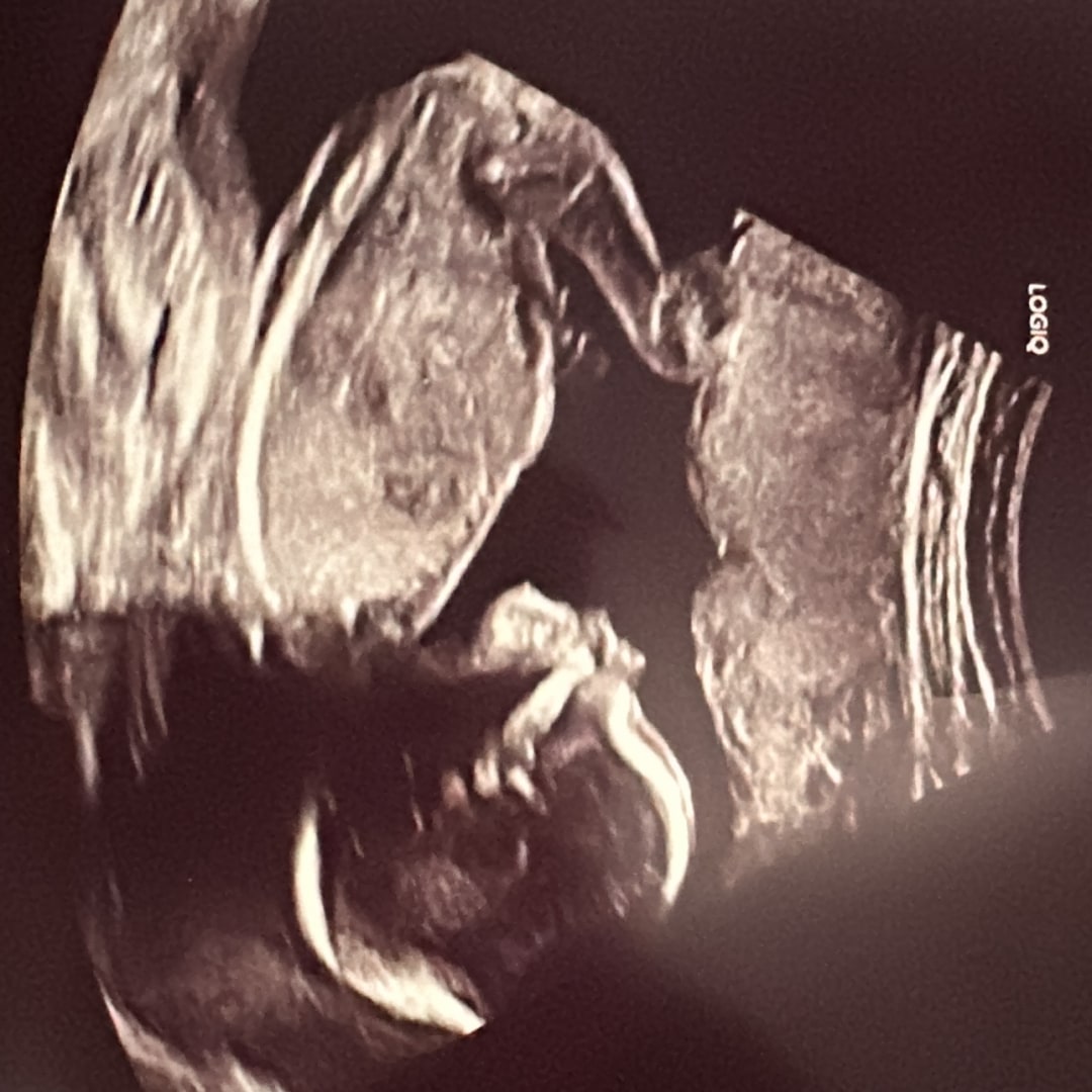 Photo shared by Dahlia for their Babylist baby registry.