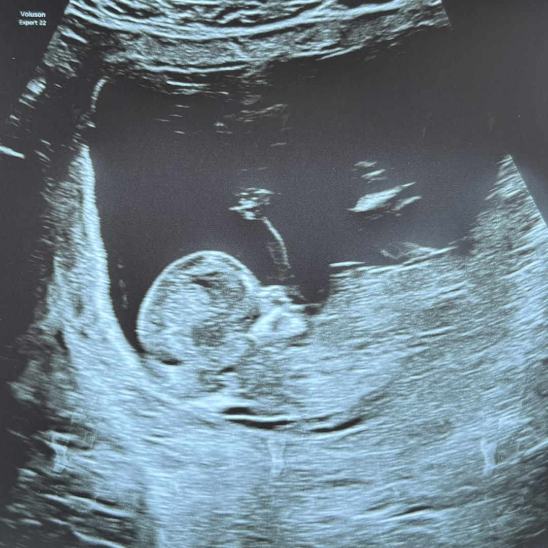 Photo shared by Jesseka for their Babylist baby registry.