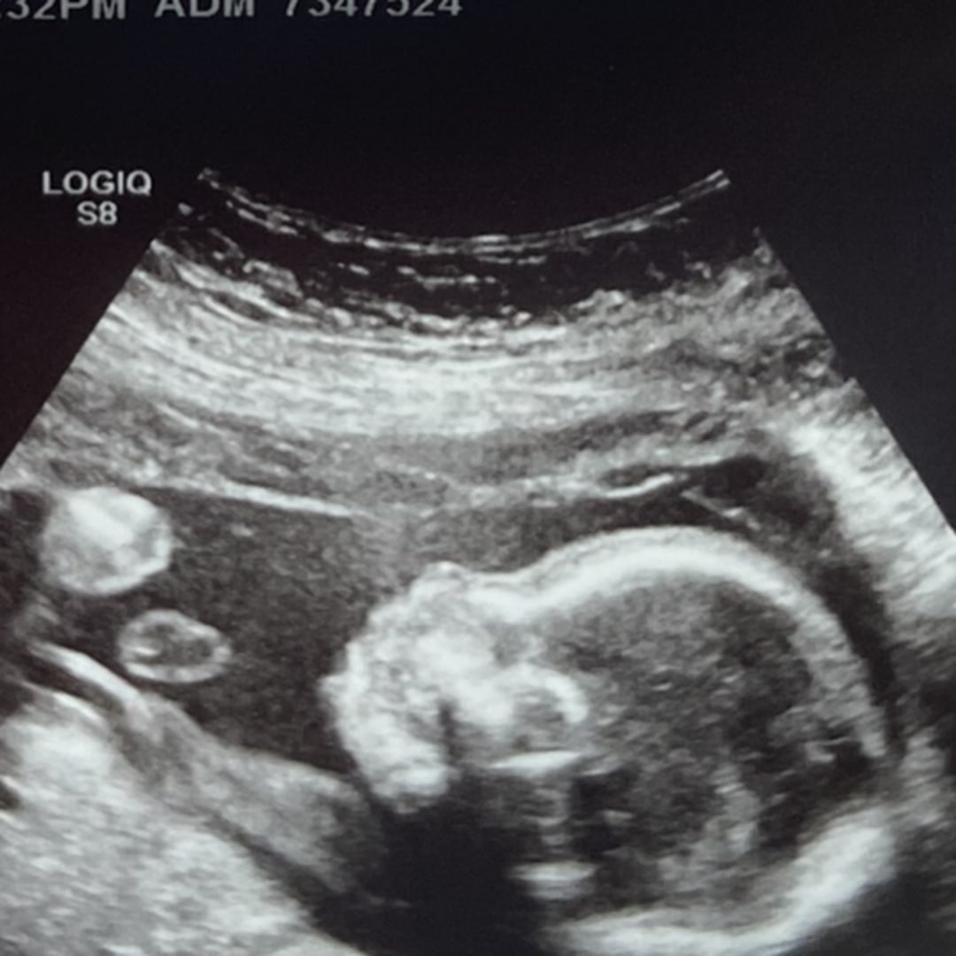 Photo shared by Kate-Lynn for their Babylist baby registry.