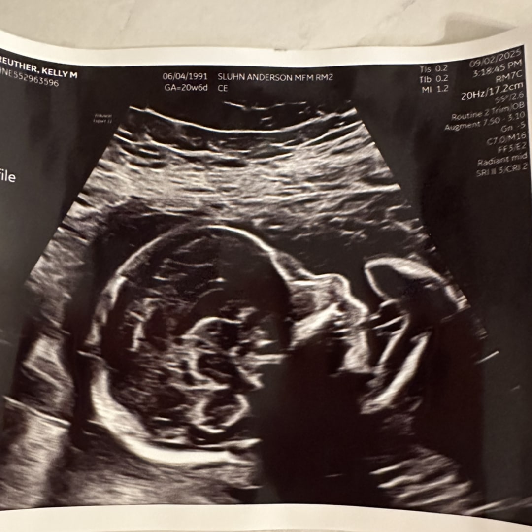 Photo shared by Kelly for their Babylist baby registry.
