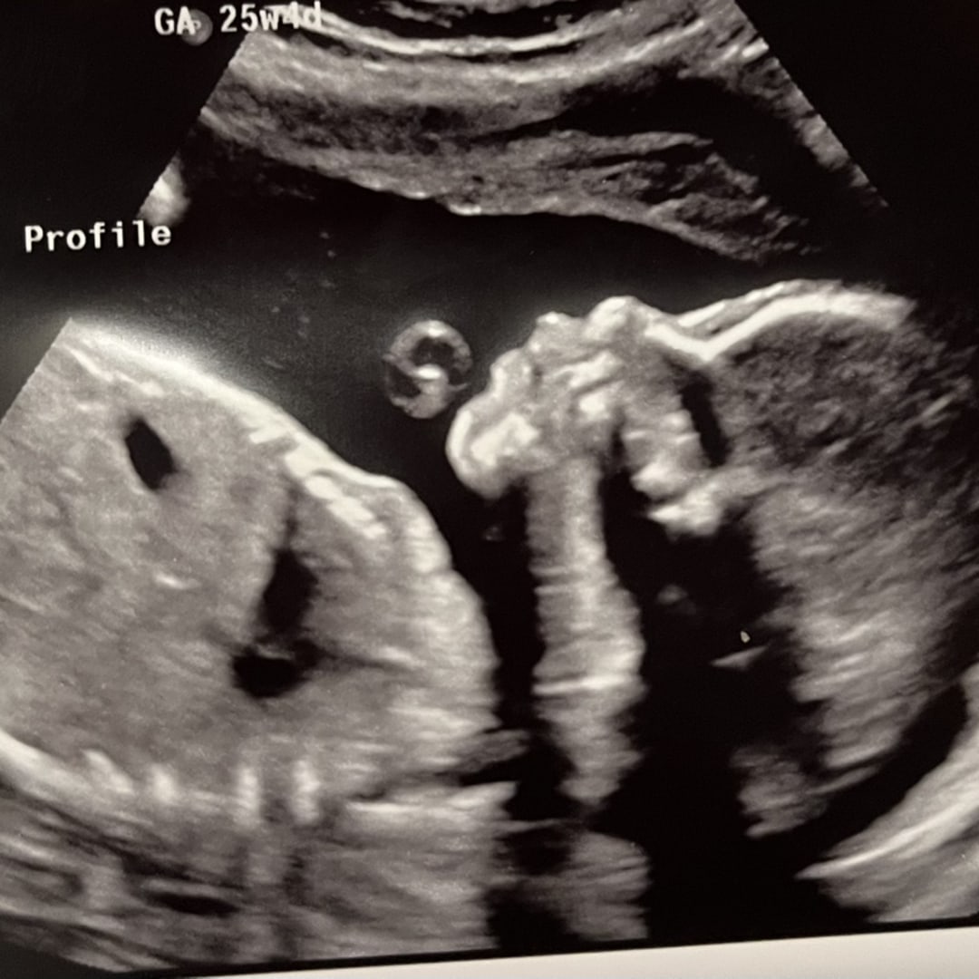 Photo shared by Selena for their Babylist baby registry.