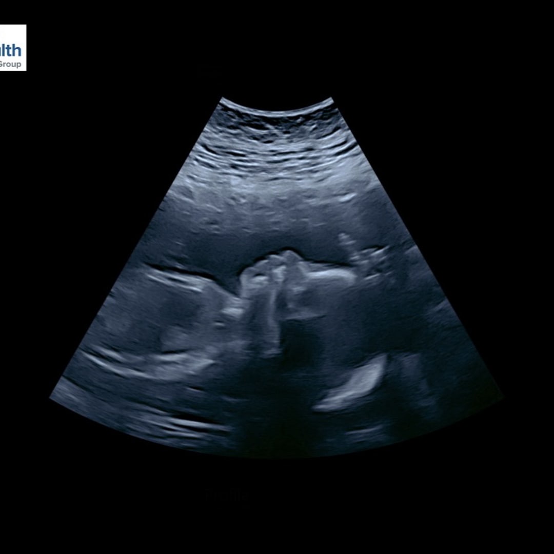 Photo shared by Myranda for their Babylist baby registry.