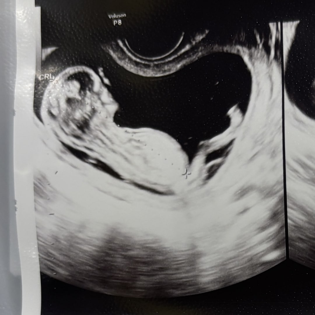 Photo shared by Yuyu for their Babylist baby registry.