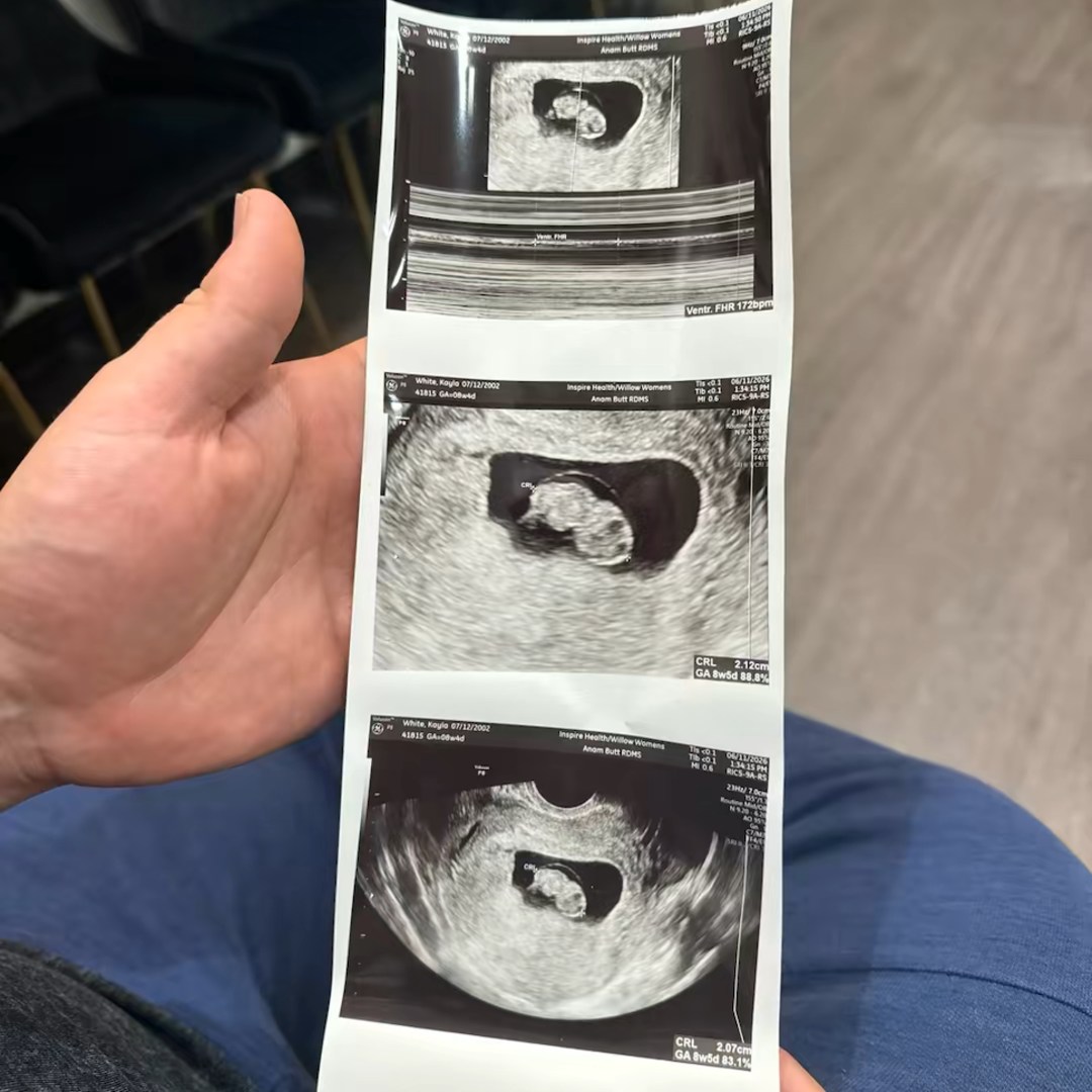 Photo shared by Kayla for their Babylist baby registry.