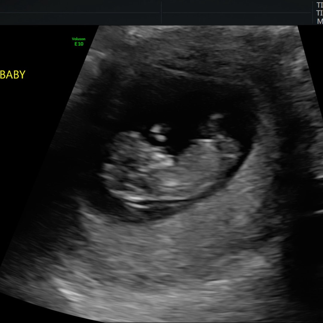Photo shared by Erica for their Babylist baby registry.