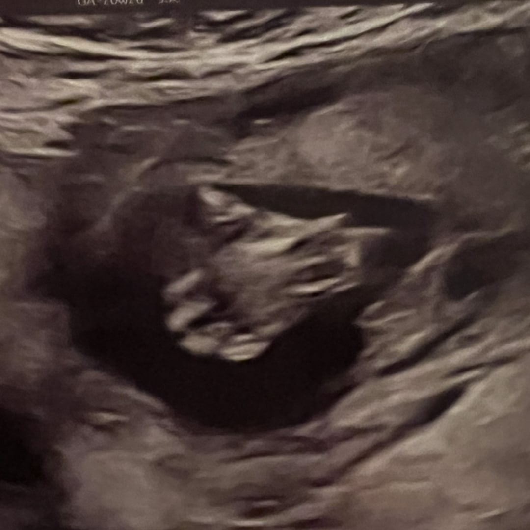 Photo shared by Katie for their Babylist baby registry.