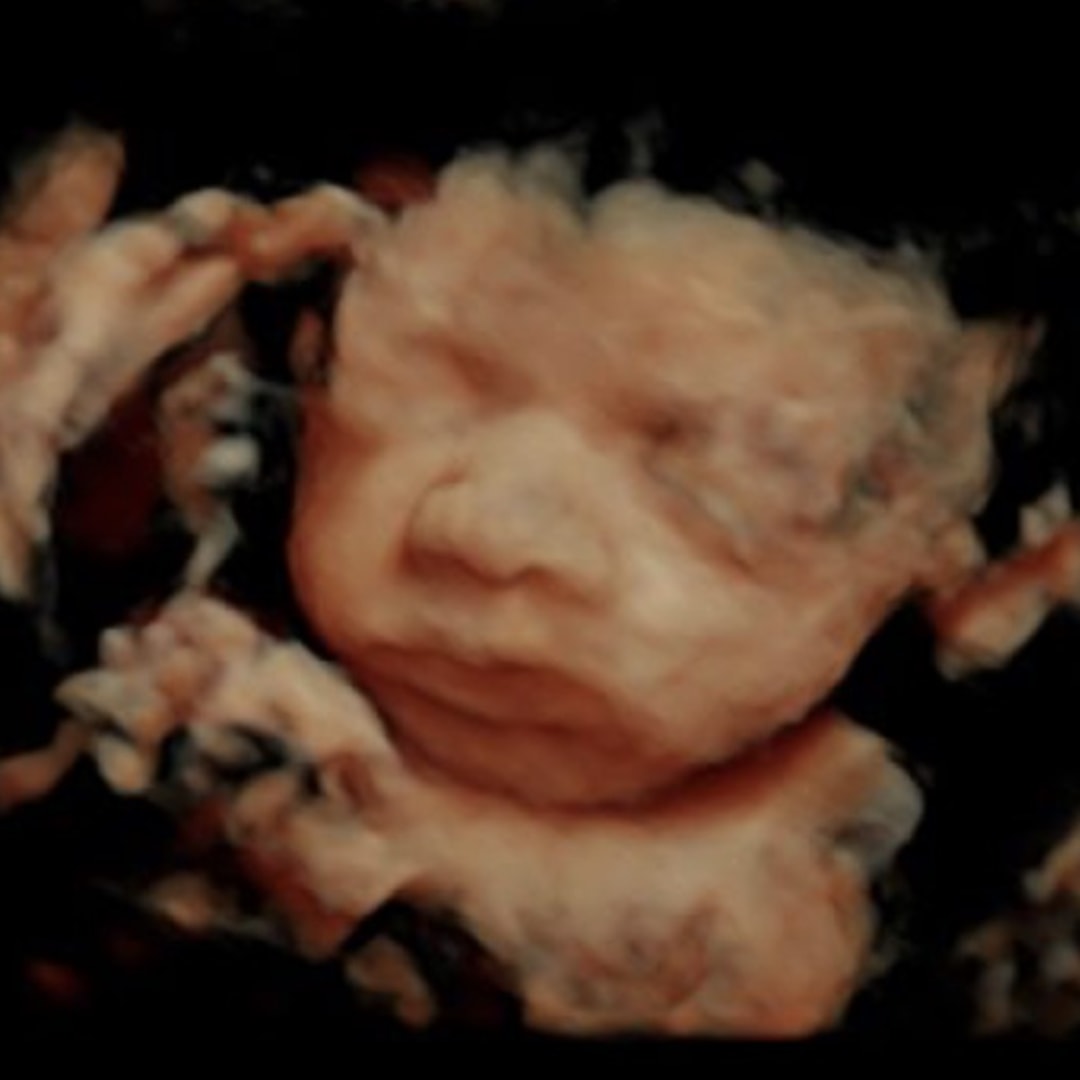 Photo shared by Cali for their Babylist baby registry.