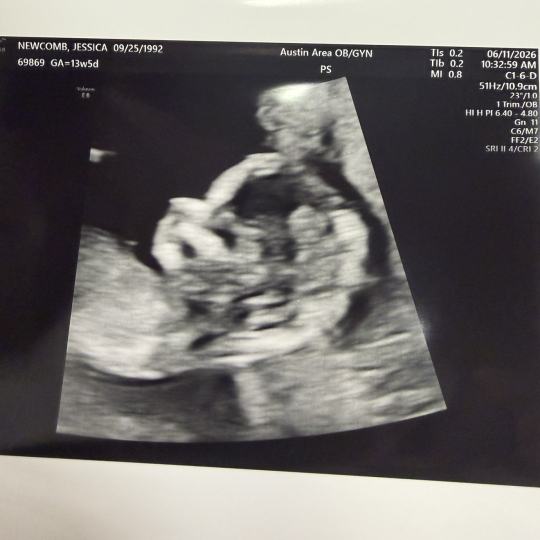 Photo shared by Jessica for their Babylist baby registry.