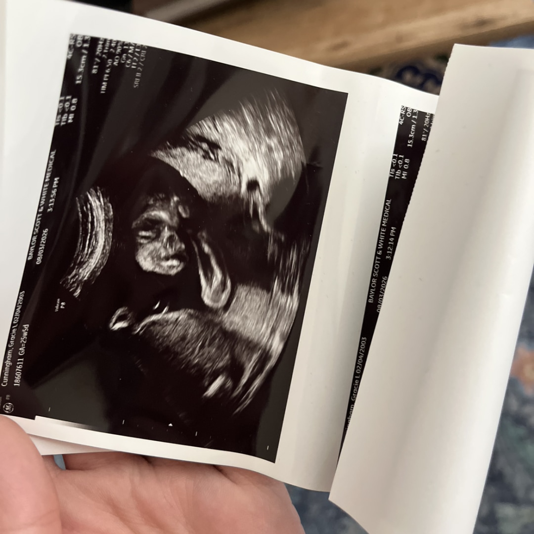 Photo shared by Gracie for their Babylist baby registry.