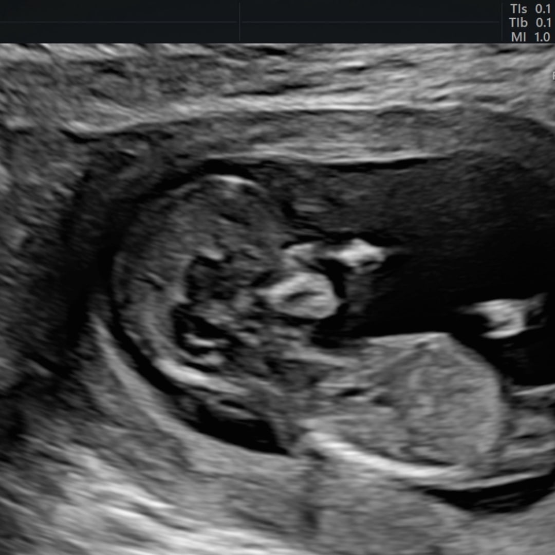 Photo shared by Marissa for their Babylist baby registry.