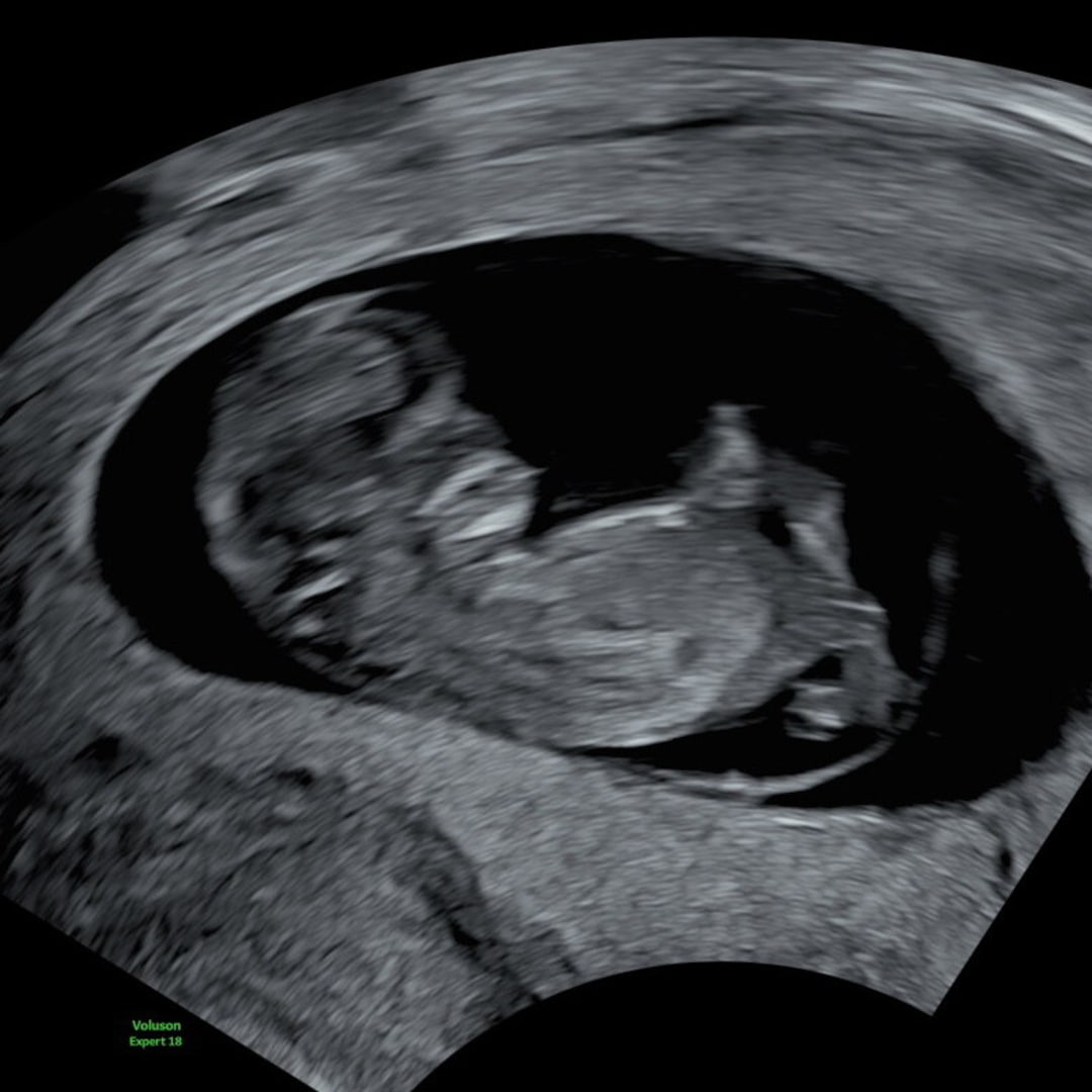 Photo shared by Brooklynn for their Babylist baby registry.