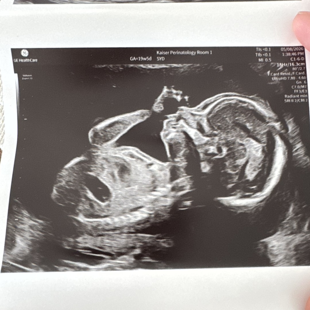 Photo shared by Allison for their Babylist baby registry.