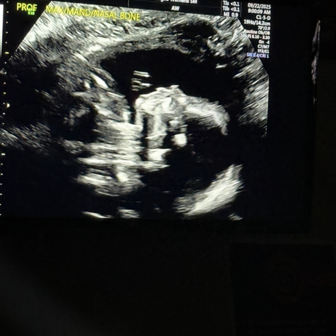 Photo shared by Jada for their Babylist baby registry.