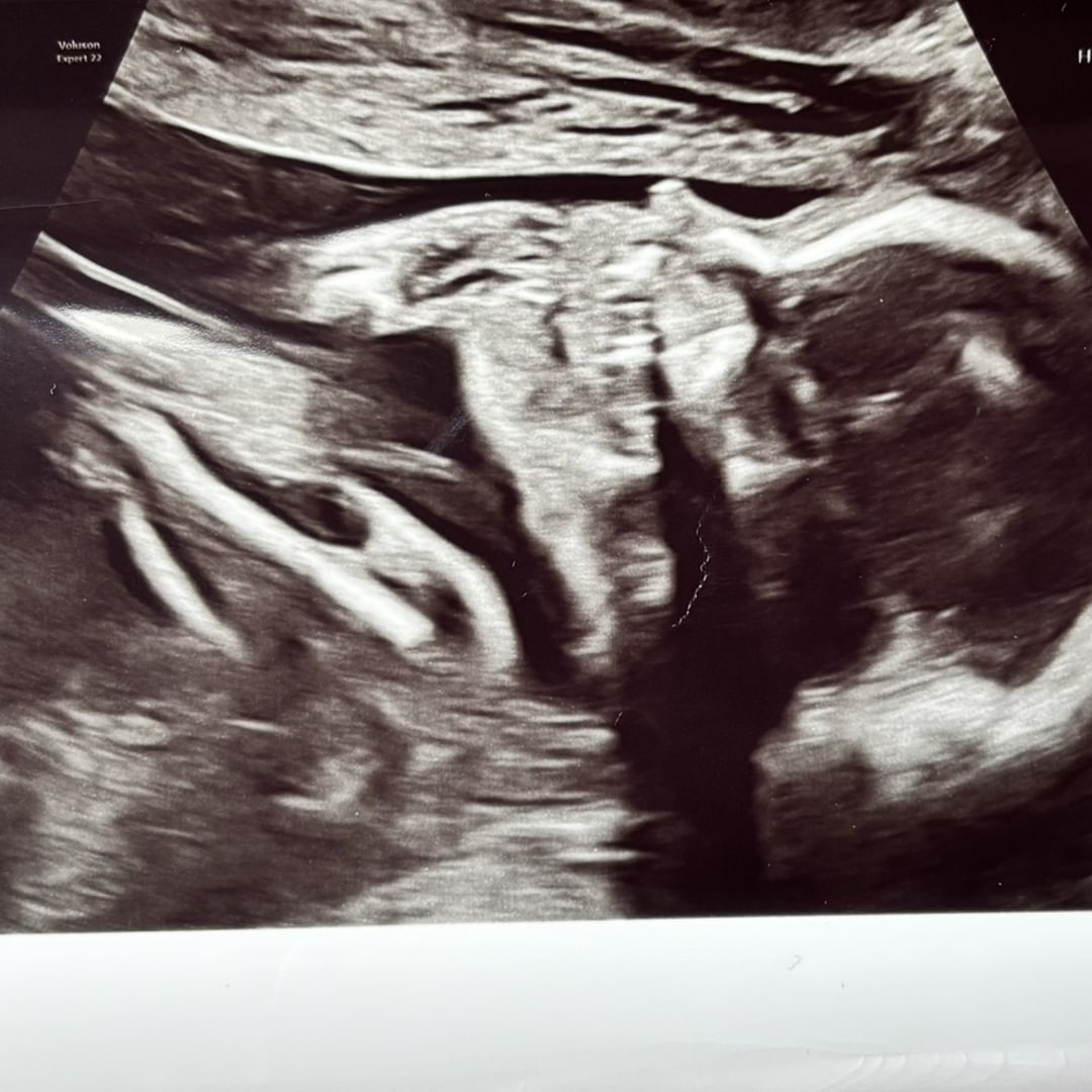 Photo shared by Hunter for their Babylist baby registry.