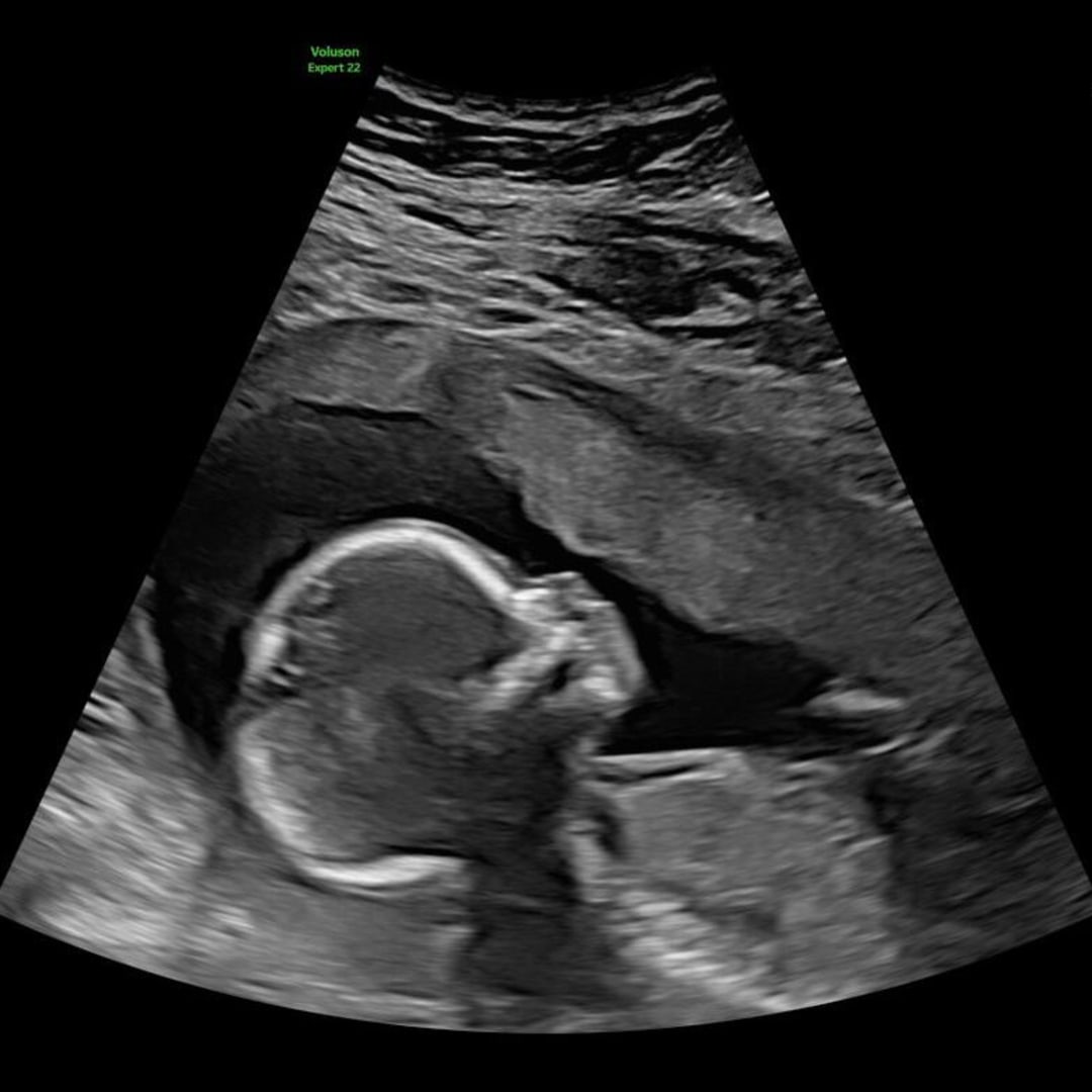 Photo shared by Jennifer for their Babylist baby registry.