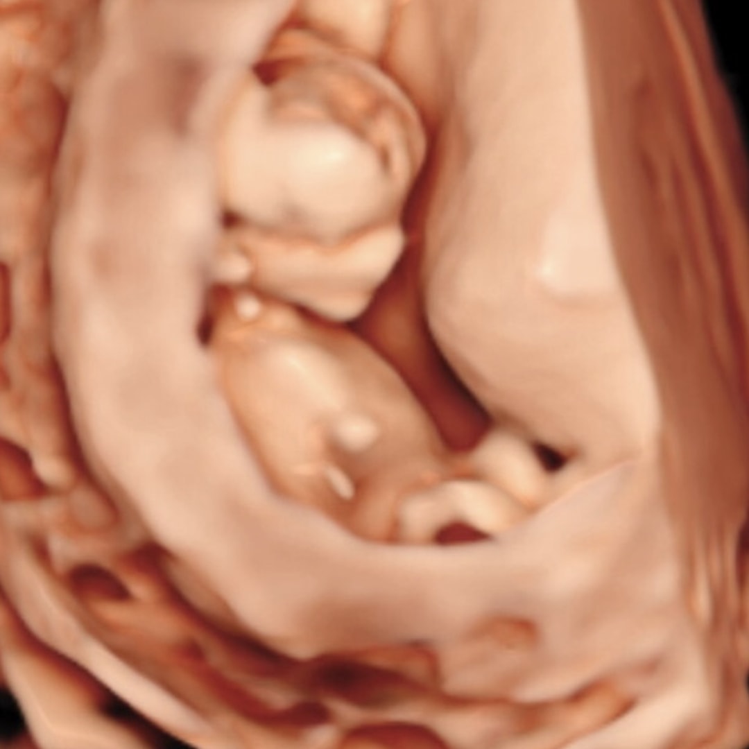 Photo shared by Kori for their Babylist baby registry.